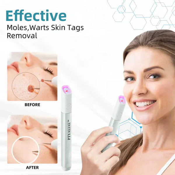 ✨Ptyalial™ All-in-One CO₂ Laser Eraser Pen | Removes Moles, Warts, Skin Flaws & Pigmentation