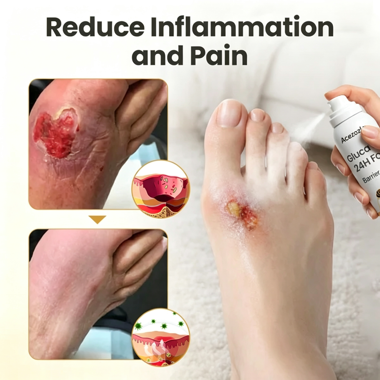 Acezozla® GlucaVeil 24H Foot Barrier Spray