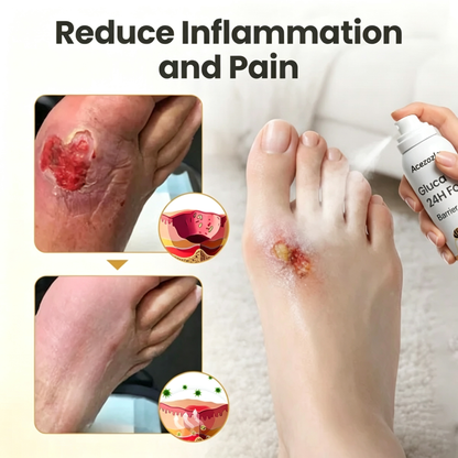 Acezozla® GlucaVeil 24H Foot Barrier Spray