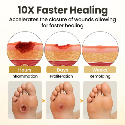 Acezozla® GlucaVeil 24H Foot Barrier Spray
