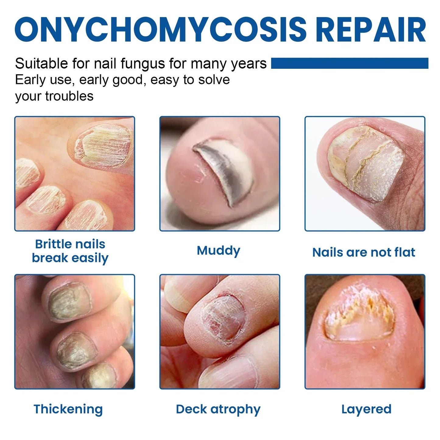 Acezozla® Fungus Nail Repair Patches